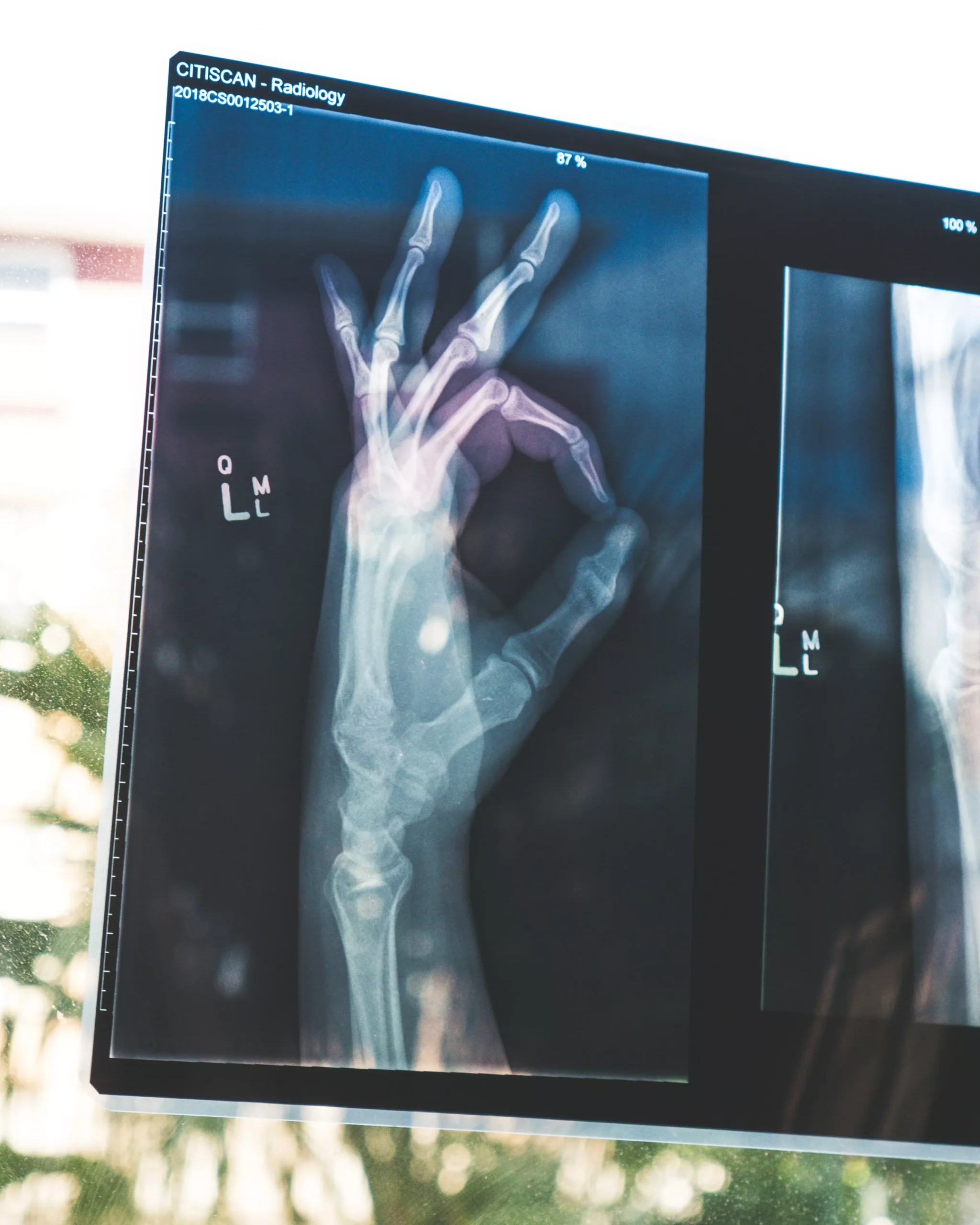 How Much Does an MRI Cost Without Insurance?